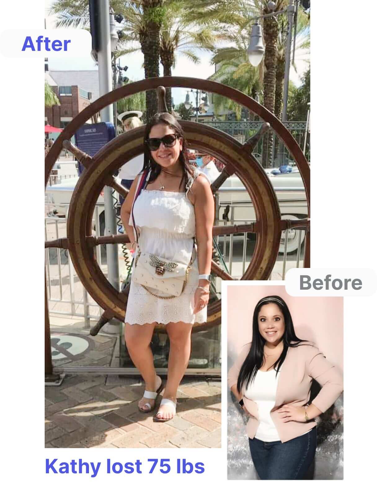 Before and After Picture of Kathy After Weight Loss surgery